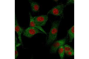 Immunofluorescence staining of U87MG cells using CD73 Mouse Monoclonal Antibody (NT5E/2545) followed by goat anti-Mouse IgG conjugated to CF488 (green). (CD73 Antikörper)