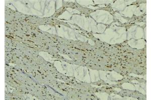 ABIN6277442 at 1/100 staining Mouse muscle tissue by IHC-P. (TRIM63 Antikörper  (N-Term))