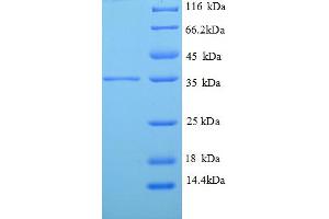 SDS-PAGE (SDS) image for Tropomyosin-2 (TPM2) (AA 14-284), (partial) protein (His tag) (ABIN4976309)