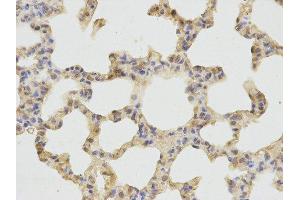 Immunohistochemistry (IHC) image for anti-Cathepsin D (CTSD) antibody (ABIN1872099) (Cathepsin D Antikörper)