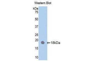 Western Blotting (WB) image for anti-Interleukin 18 Receptor Accessory Protein (IL18RAP) (AA 117-240) antibody (ABIN1859375)