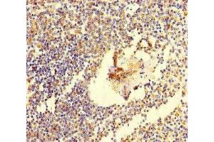 Immunohistochemistry of paraffin-embedded human spleen tissue using ABIN7171802 at dilution of 1:100 (TSBP1 (AA 239-476) Antikörper)