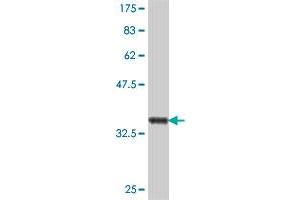 Western Blot detection against Immunogen (37 KDa) . (PTGR1 Antikörper  (AA 230-328))