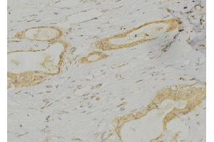 ABIN6277357 at 1/100 staining Human lung tissue by IHC-P.