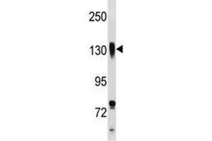 Integrin beta 1 antibody western blot analysis in NCI-H292 lysate. (ITGB1 Antikörper  (AA 759-785))