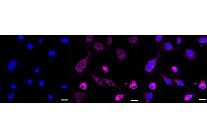 anti-RAP1A + RAP1B antibody
