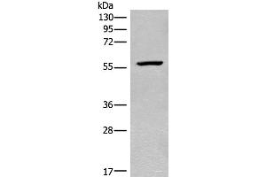 Western blot analysis of Mouse heart tissue lysate using CDADC1 Polyclonal Antibody at dilution of 1:450 (CDADC1 Antikörper)