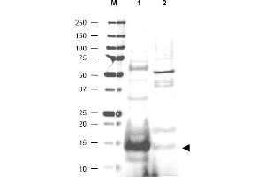 Image no. 1 for anti-Ubiquitin-Conjugating Enzyme E2N (UBE2N) (AA 40-51) antibody (ABIN401175) (UBE2N Antikörper  (AA 40-51))