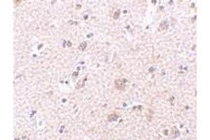 Immunohistochemistry of ARMET in human brain tissue with ARMET polyclonal antibody  at 2. (MANF Antikörper  (N-Term))