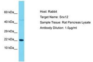 Image no. 1 for anti-Sorting Nexin 12 (SNX12) (AA 86-135) antibody (ABIN6750493) (SNX12 Antikörper  (AA 86-135))