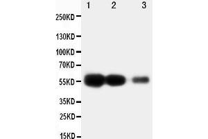 Anti-RAGE antibody, Western blotting Lane 1: Recombinant Human RAGE Protein 10ng Lane 2: Recombinant Human RAGE Protein 5ng Lane 3: Recombinant Human RAGE Protein 2.