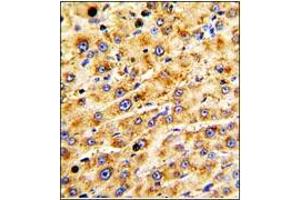 Immunohistochemistry (Paraffin-embedded Sections) (IHC (p)) image for anti-ADAM Metallopeptidase with Thrombospondin Type 1 Motif, 13 (ADAMTS13) (AA 836-866) antibody (ABIN359601)