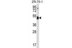 Western Blotting (WB) image for anti-CUGBP, Elav-Like Family Member 1 (CELF1) antibody (ABIN2997688)