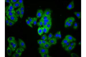 Immunofluorescence staining of HepG2 cells with ABIN7159352 at 1:133, counter-stained with DAPI.