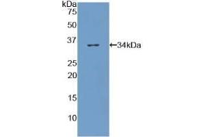 Western Blotting (WB) image for anti-Collagen, Type VII, alpha 1 (COL7A1) (AA 190-472) antibody (ABIN7434716)