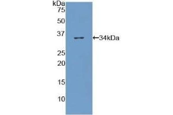 COL7 Antikörper  (AA 190-472)