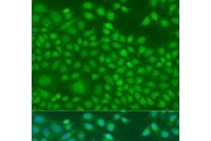 Immunofluorescence analysis of U2OS cells using NIN Polyclonal Antibody at dilution of 1:100. (Ninein Antikörper)