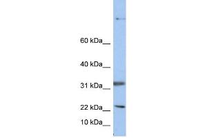 WB Suggested Anti-SEAntibody Titration:  0. (Sep 15 Antikörper  (Middle Region))