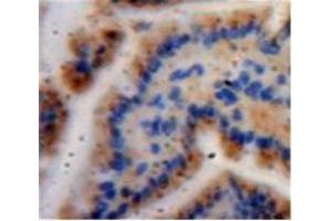 Used in DAB staining on fromalin fixed paraffin-embedded Bowels tissue (Caspase 6 Antikörper  (AA 194-293))