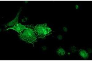 Anti-DTNA mouse monoclonal antibody (ABIN2454048) immunofluorescent staining of COS7 cells transiently transfected by pCMV6-ENTRY DTNA (RC223952). (DTNA Antikörper)