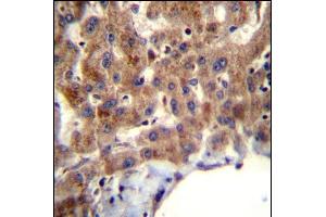 MBNL2 Antibody (C-term) (ABIN656947 and ABIN2846136) immunohistochemistry analysis in formalin fixed and paraffin embedded human liver tissue followed by peroxidase conjugation of the secondary antibody and DAB staining. (MBNL2 Antikörper  (C-Term))