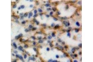 Used in DAB staining on fromalin fixed paraffin-embedded Spleen tissue (CD160 Antikörper  (AA 37-154))