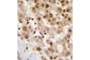Immunohistochemistry (Paraffin-embedded Sections) (IHC (p)) image for anti-Immediate Early Response 3 (IER3) (AA 45-73), (N-Term) antibody (ABIN952818)