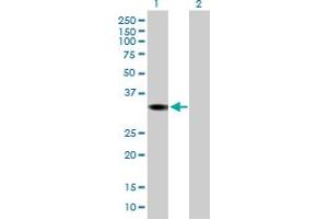 Western Blot analysis of DHRS1 expression in transfected 293T cell line by DHRS1 MaxPab polyclonal antibody. (DHRS1 Antikörper  (AA 1-313))