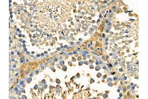 Phospho-DDR1 (Tyr180) Antibody at 1/100 staining Rat testis tissue by IHC-P. (DDR1 Antikörper  (pTyr180))