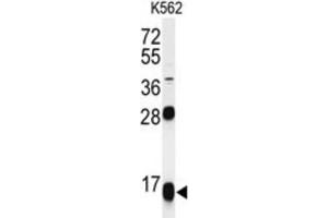 Western Blotting (WB) image for anti-Ribosomal Protein S15a (RA) antibody (ABIN3002138) (RPS15A Antikörper)
