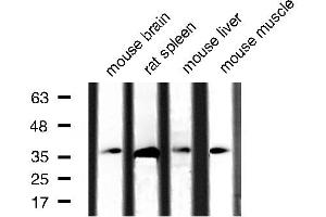 Western blot analysis of extracts of various tissue sample,using Caspase 3 Antibody . (Caspase 3 Antikörper  (Internal Region))