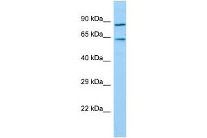 Host: Rabbit Target Name: TIGD7 Sample Type: Hela Whole Cell lysates Antibody Dilution: 1.