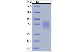 SDS-PAGE (SDS) image for Tumor Necrosis Factor (Ligand) Superfamily, Member 8 (TNFSF8) (AA 63-234) (Active) protein (His tag) (ABIN6809854)
