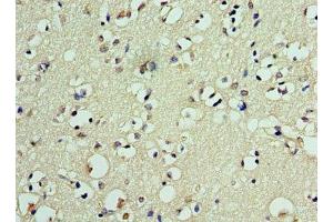 Immunohistochemistry of paraffin-embedded human brain tissue using ABIN7150359 at dilution of 1:100 (DEDD2 Antikörper  (AA 1-240))