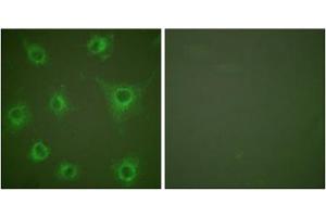 Immunofluorescence analysis of COS7 cells, using COL2 antibody (ABIN5976364). (COL2 Antikörper  (N-Term))