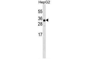 ANR46 Antibody (N-term) western blot analysis in HepG2 cell line lysates (35 µg/lane). (ANKRD46 Antikörper  (N-Term))