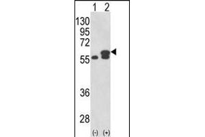 Western blot analysis of PDIA3 (arrow) using rabbit polyclonal PDIA3 Antibody (Center) (ABIN389465 and ABIN2839530).