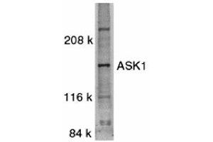 Western Blotting (WB) image for anti-Mitogen-Activated Protein Kinase Kinase Kinase 5 (MAP3K5) (C-Term) antibody (ABIN1030259) (ASK1 Antikörper  (C-Term))