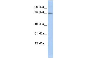 WB Suggested Anti-ZNF619 Antibody Titration:  0. (ZNF619 Antikörper  (N-Term))