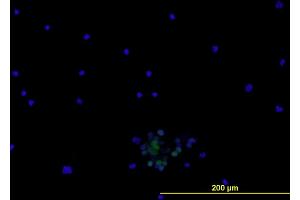 Immunofluorescence (IF) image for anti-Endoglin (ENG) (AA 27-658) antibody (ABIN2752224)