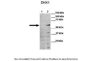 Lanes:   Lane 1: 30ug human PLC/PRF5 cell lysate Lane 2: 30ug DKK1 PLC/PRF5 cell lysate   Primary Antibody Dilution:   1:1000  Secondary Antibody:   Anti-rabbit-HRP Anti-rabbit-HRP  Secondary Antibody Dilution:   1:10,000  Gene Name:   DKK1 a  Submitted by:   Dr Frankie Ko Chi Fat, Lo-Kong Chan, Irene O. (DKK1 Antikörper  (C-Term))