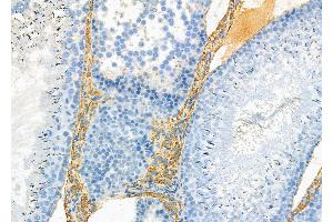 ABIN7093861 and ABIN7097904 at 1/100 staining Rat kidney tissue by IHC-P.
