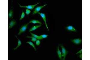 Immunofluorescence staining of Hela cells with ABIN7146380 at 1:133, counter-stained with DAPI. (CABP4 Antikörper  (AA 1-107))