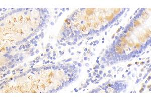 Detection of SCG3 in Human Colon Tissue using Polyclonal Antibody to Secretogranin III (SCG3) (SCG3 Antikörper  (AA 20-468))