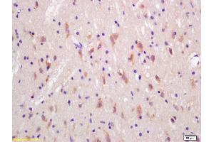 Formalin-fixed and paraffin embedded rat brain labeled with Rabbit Anti Huntingtin Polyclonal Antibody, Unconjugated (ABIN1387692) at 1:200 followed by conjugation to the secondary antibody and DAB staining (Huntingtin Antikörper  (AA 751-850))