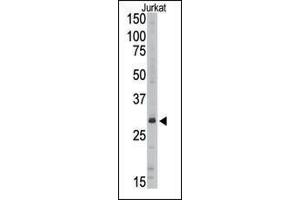 Western blot analysis of anti-SIRT5 Pab (ABIN390180 and ABIN2840671) in Jurkat cell line lysate (35 μg/lane). (SIRT5 Antikörper  (C-Term))