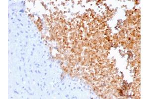 Formalin-fixed, paraffin-embedded human lung stained with Fodrin Mouse Monoclonal Antibody (SPTAN1/3352). (SPTAN1 Antikörper  (AA 2351-2475))