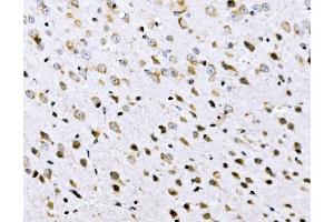 IHC analysis of VPRBP/DCAF1 using anti-VPRBP/DCAF1 antibody (ABIN7602005). (DDB1 and CUL4-Associated Factor 1 (DCAF1) (AA 540-861) Antikörper)