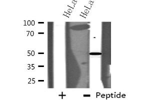 Western blot analysis of extracts from HeLa cells using MAPK10 antibody. (MAPK10 Antikörper  (C-Term))