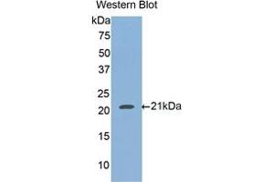 Western blot analysis of the recombinant protein. (HFE2 Antikörper  (AA 234-416))